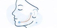 Ilustración de cirugía oral y maxilofacial